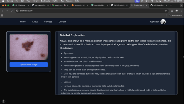 DermaWiseAI - Disease Detection